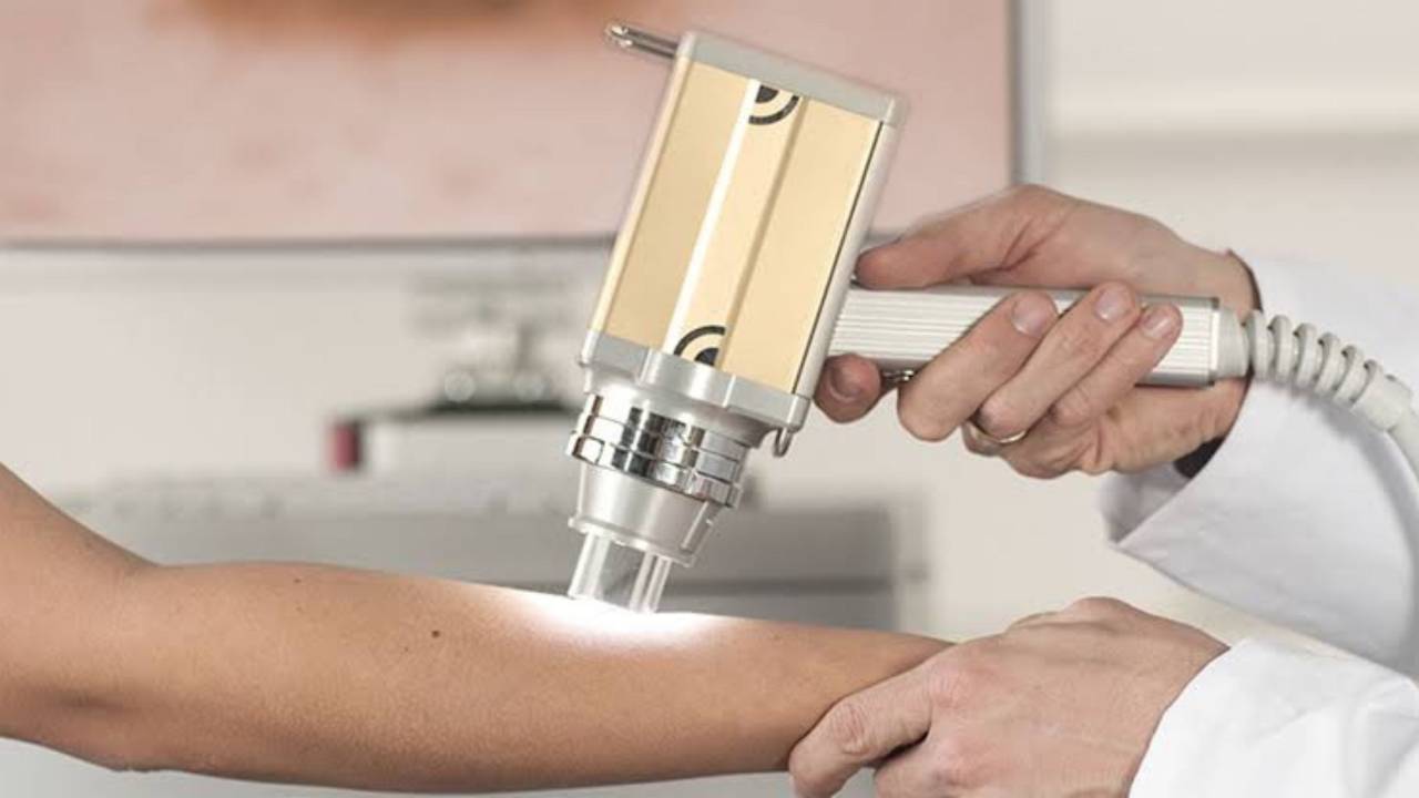 Dermatoscopia