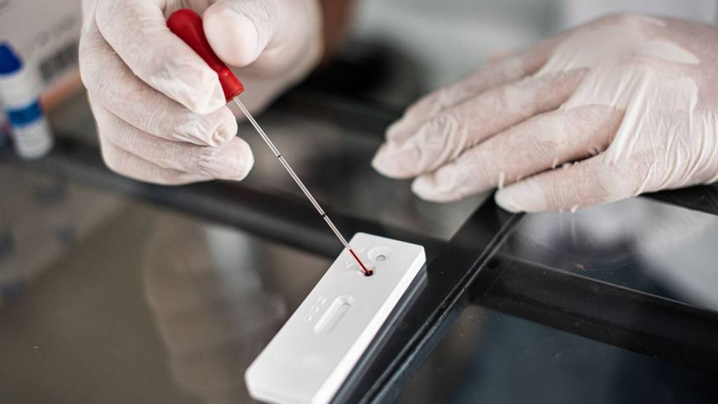 Casos de HIV aumentam no Rio; entenda os motivos