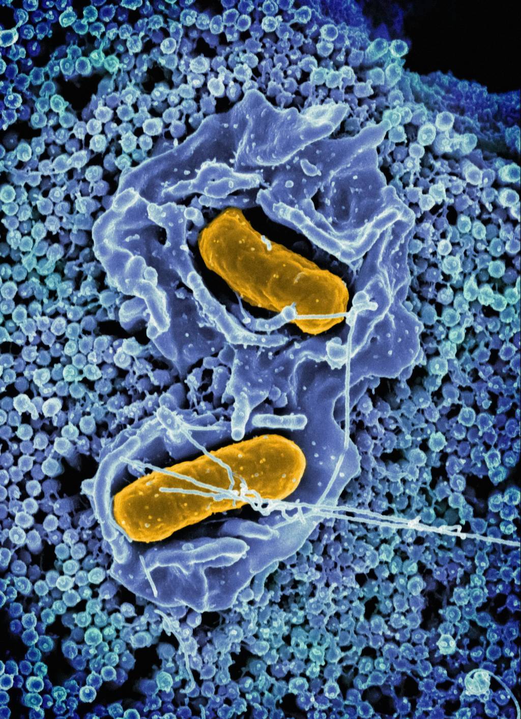 Casos de HIV e tuberculose seguem altos e preocupam saúde no Rio