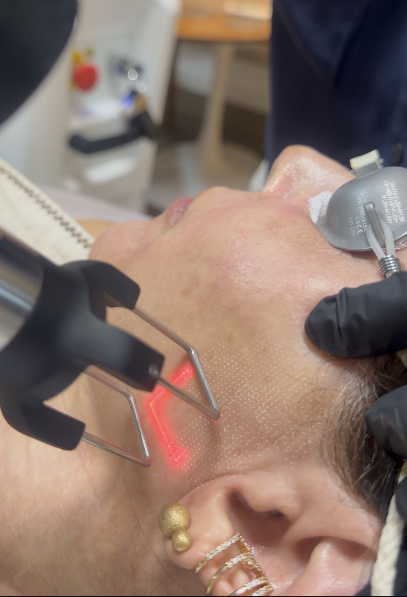 A nova estética não é parecer outra pessoa. É continuar sendo você.